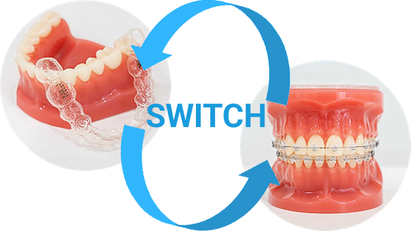 SWITCH：お好きな治療法でスタート